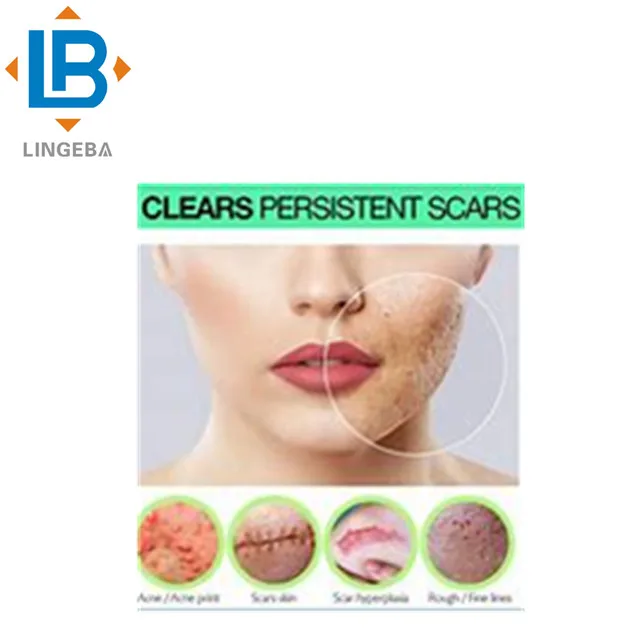 Promotional Top Quality Kojic Acid For Whitening Cream