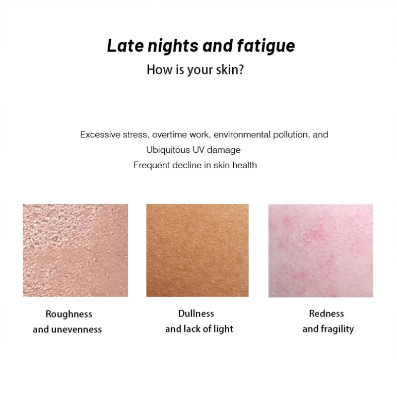 Private Label Probiotic Repair Yogurt Mask Emergency Relief Repair Improves Dull Dryness Moisturizing Spread Yogurt Face Mask