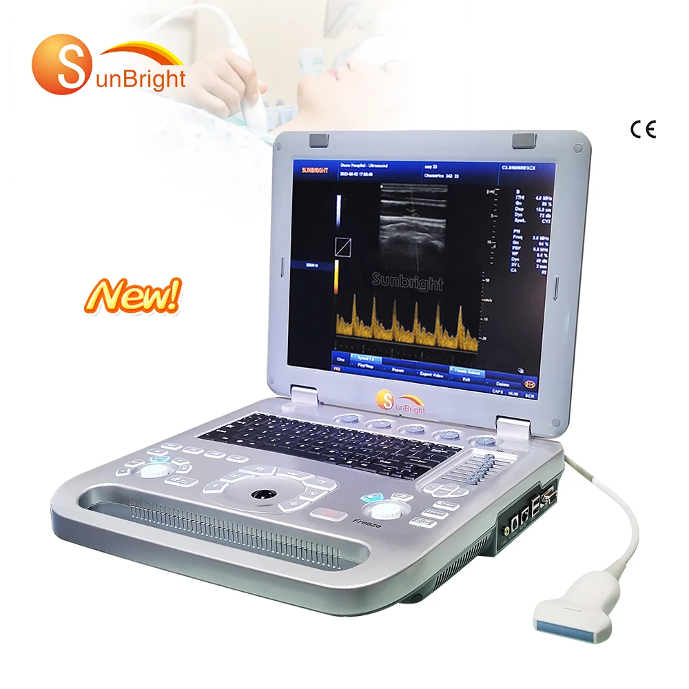 2024 ultrasound scanner 3D pregnancy ultrasonic PW portatil ultrasound model