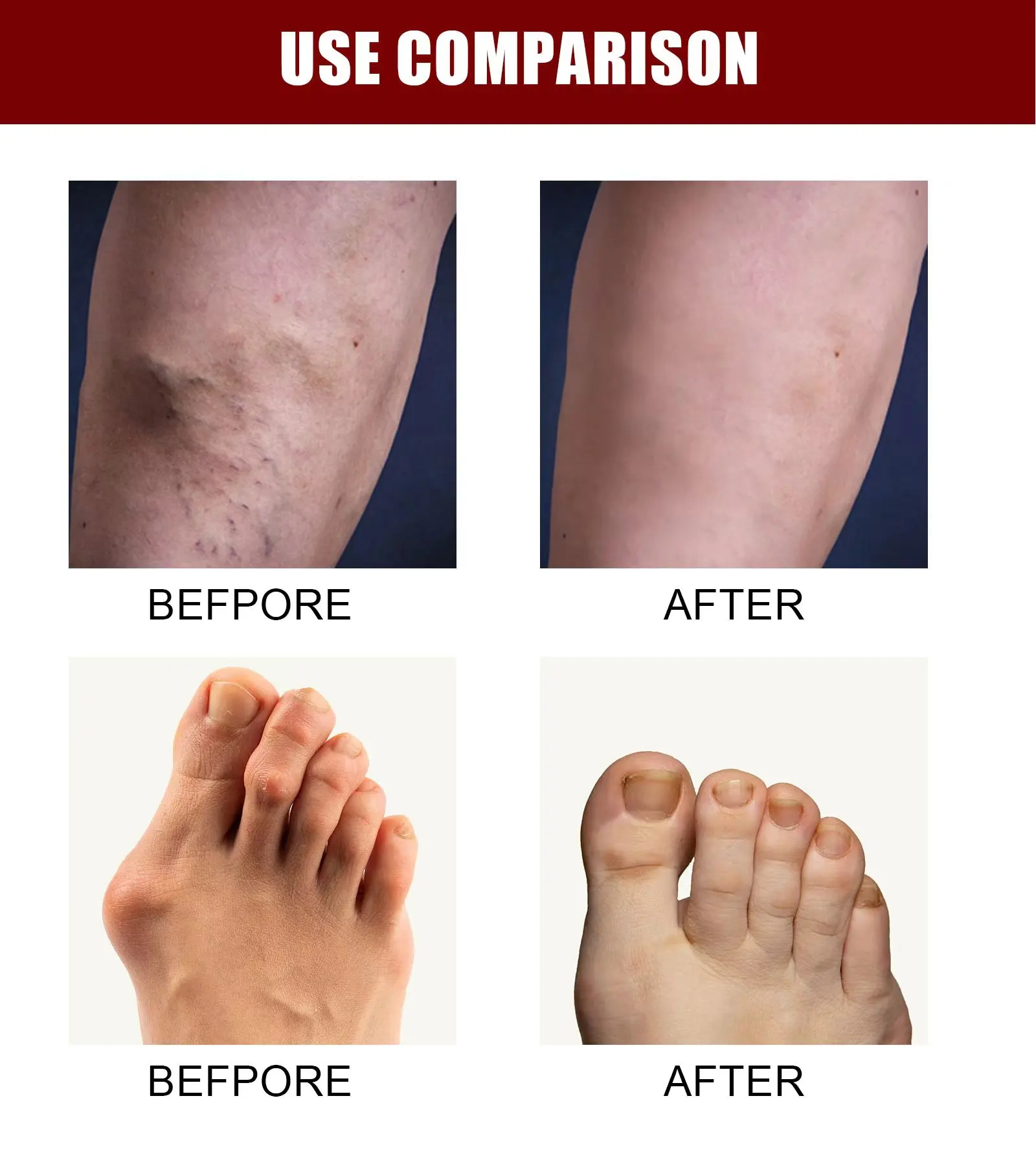 Relieves Sore Bones And Corrects Deformed Joints Perfect Intensive Concentrate Cream Joint & bone Therapy Collagen Cream