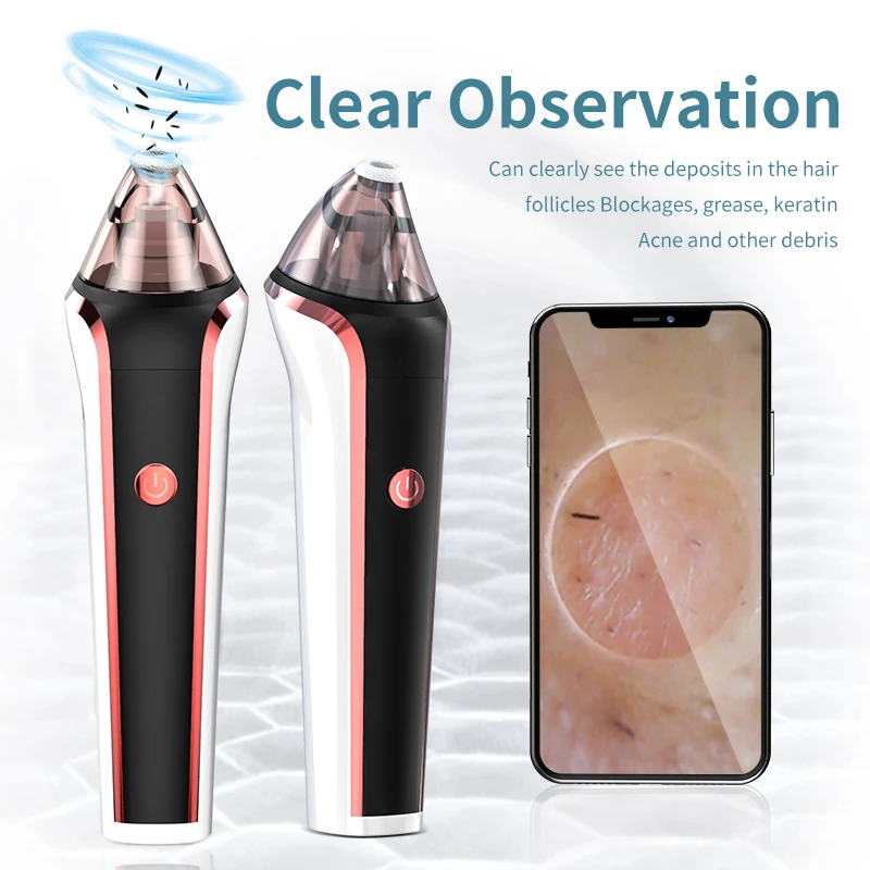 Custom wholesale electric pore nose cleaner  mobile phone visual portable mini facial whitehead vacuum blackhead remover