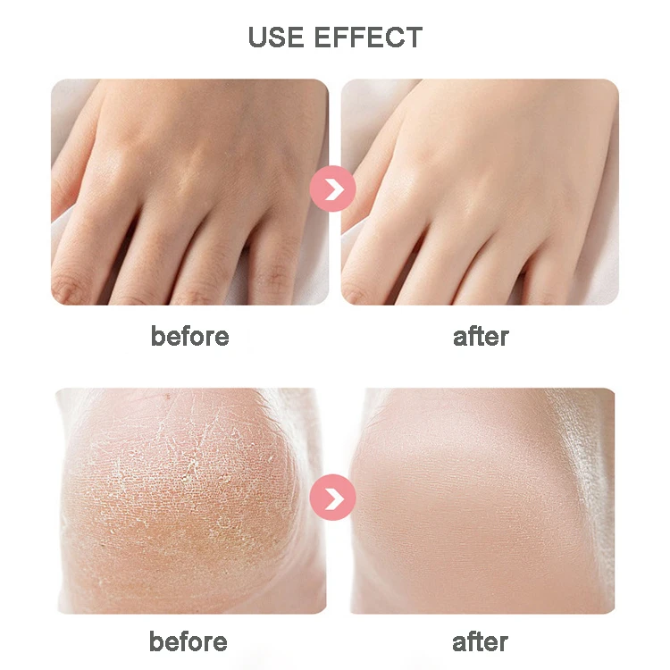 Private Label Cracked Heel Repair Exfoliante Anti-chapping Anti Dry Skin Mini Vegan Repair Care Solid Hand Foot Cream Bar