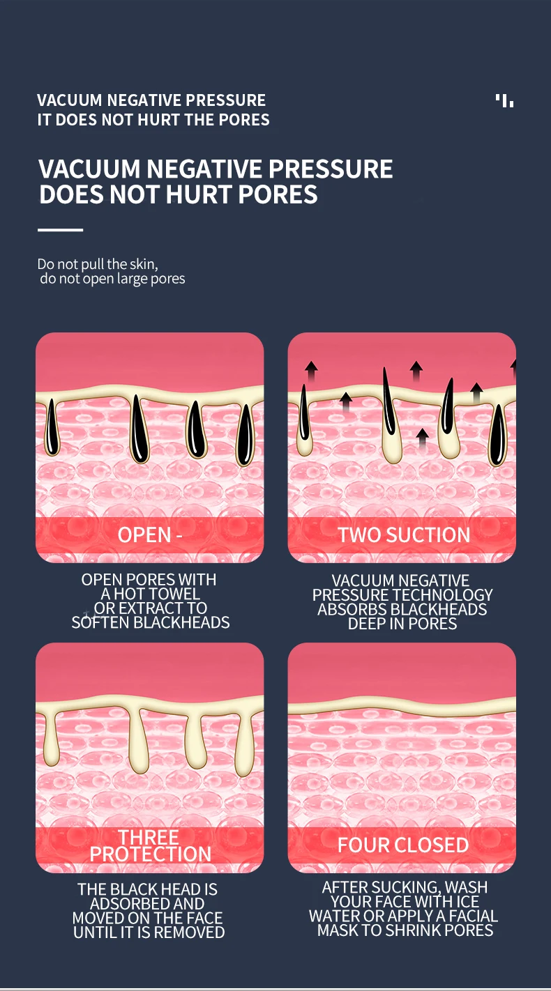 vacuum blackhead remover