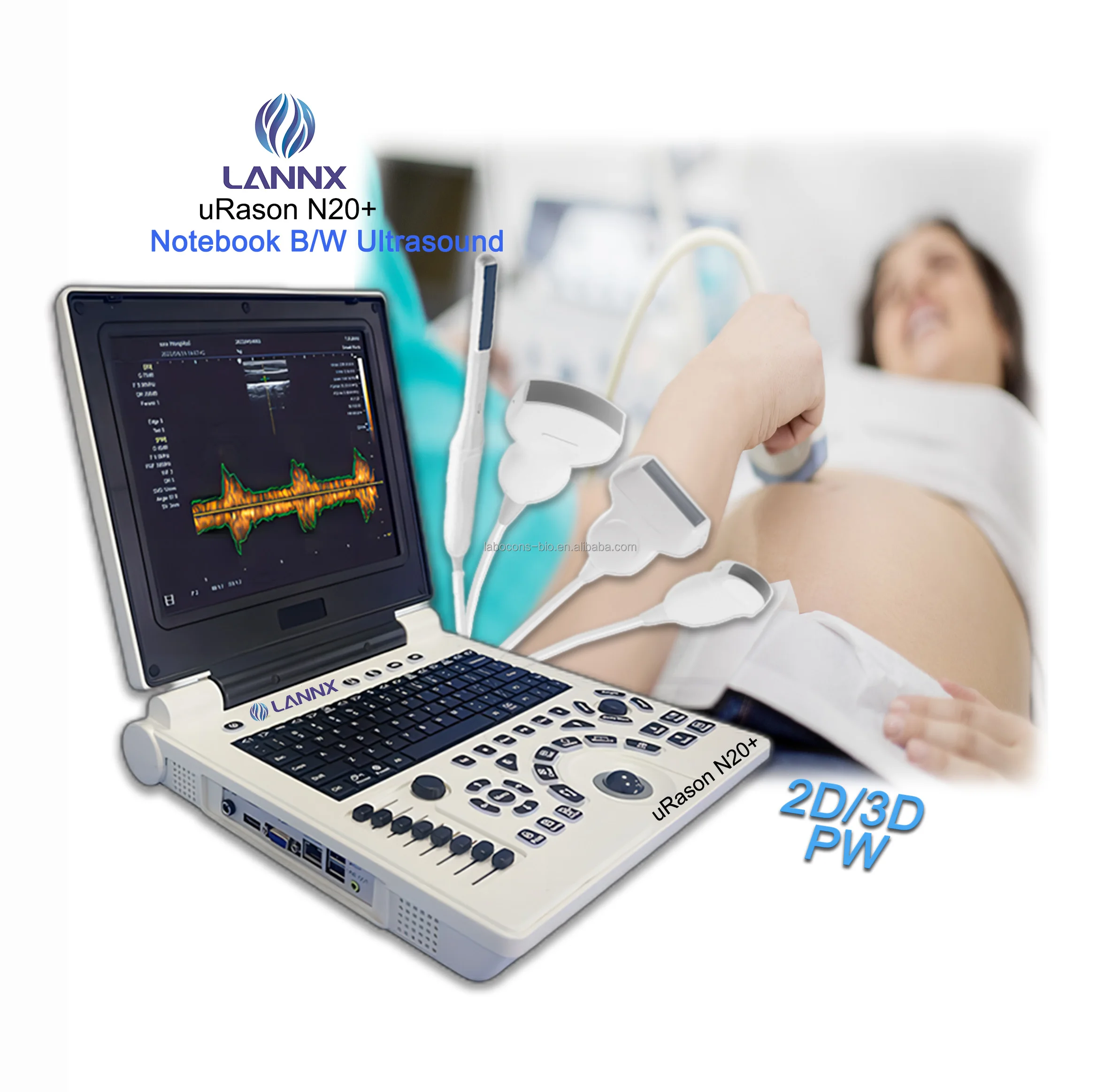 LANNX uRason N20 + дешевая цена портативная 12 1-дюймовая ультразвуковая система для ноутбука 2D OB GYN P/W ультразвуковой эхограф