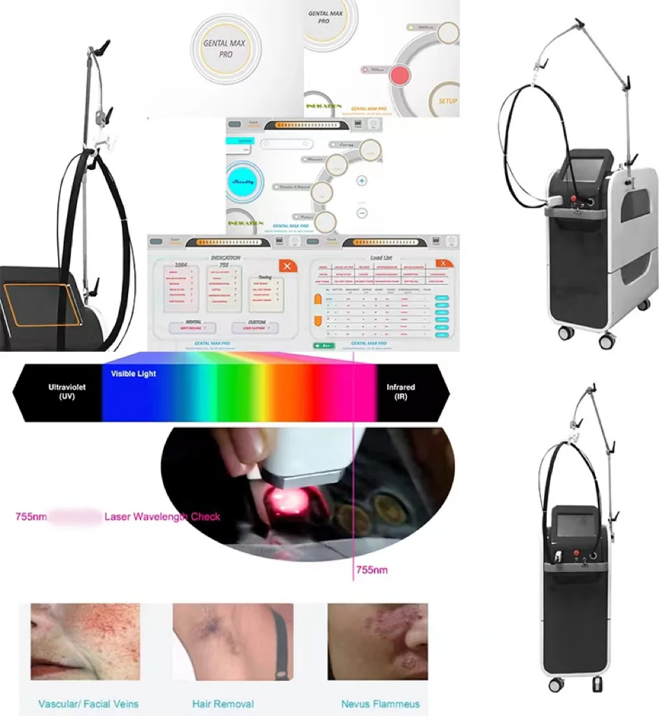 2024 latest 1000W 1200W 1600W Triple wave 808nm laser diode hair removal/755 8081064 diode laser machine price