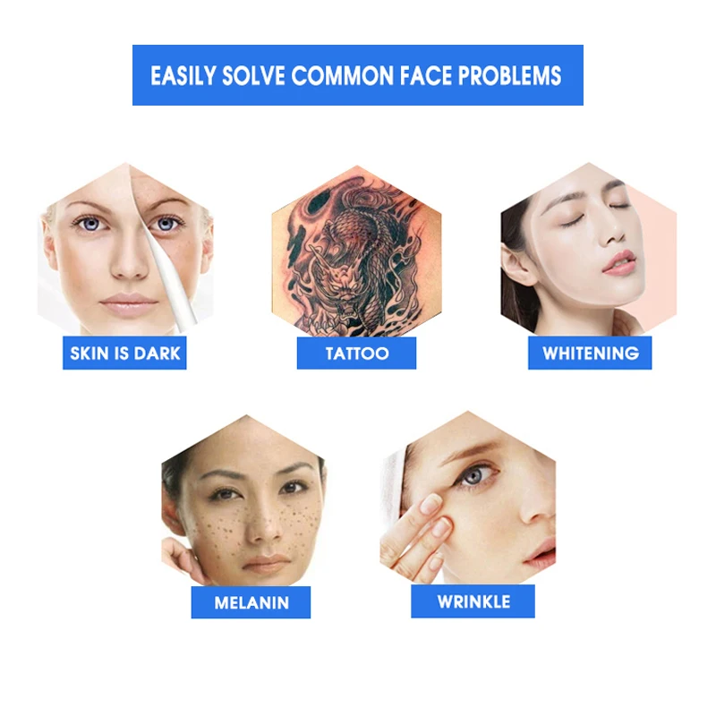 superior selling well nd yag laser tattoo removal portable 2024 tattoo removal machine tattoo removal device