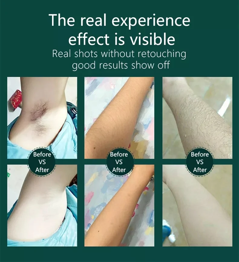 NEW IPL Laser Hair Removal Machine Updated Unlimited Flashes Painless ICE Cold Laser Hair Removal