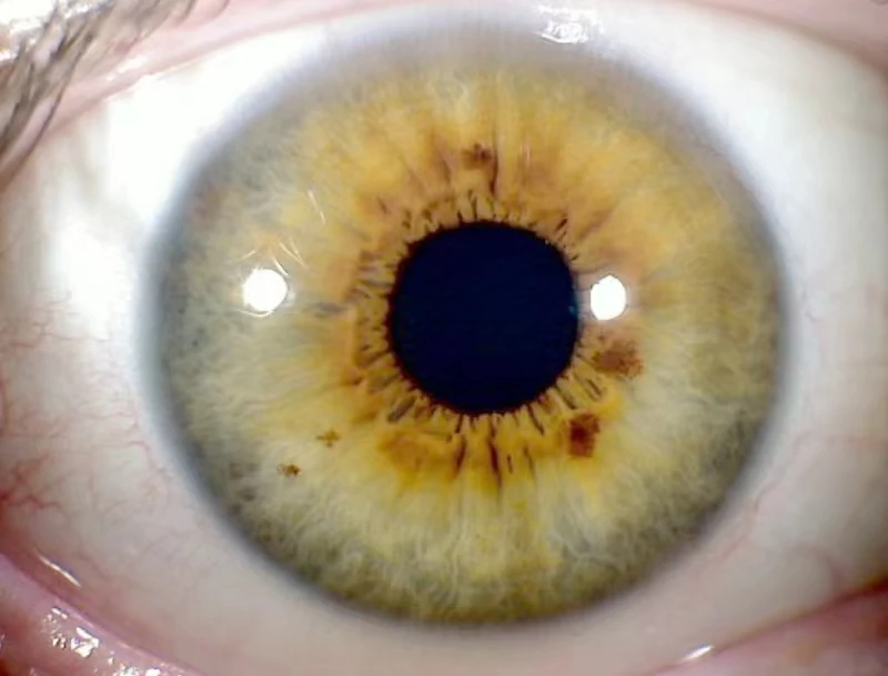 NEW 8.0MP Wireless Iriscope Camera Eye and Body Iridology Analyzer Equipment