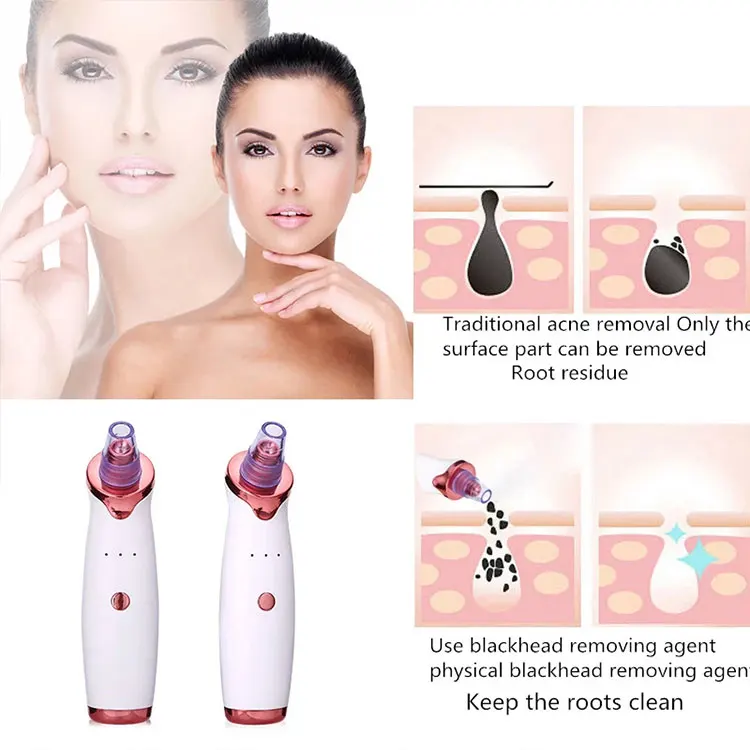Professional Portable Electric Face Vacuum Suction Blackhead Cleaner Tool Rechargeable Vacuum Blackhead Remover