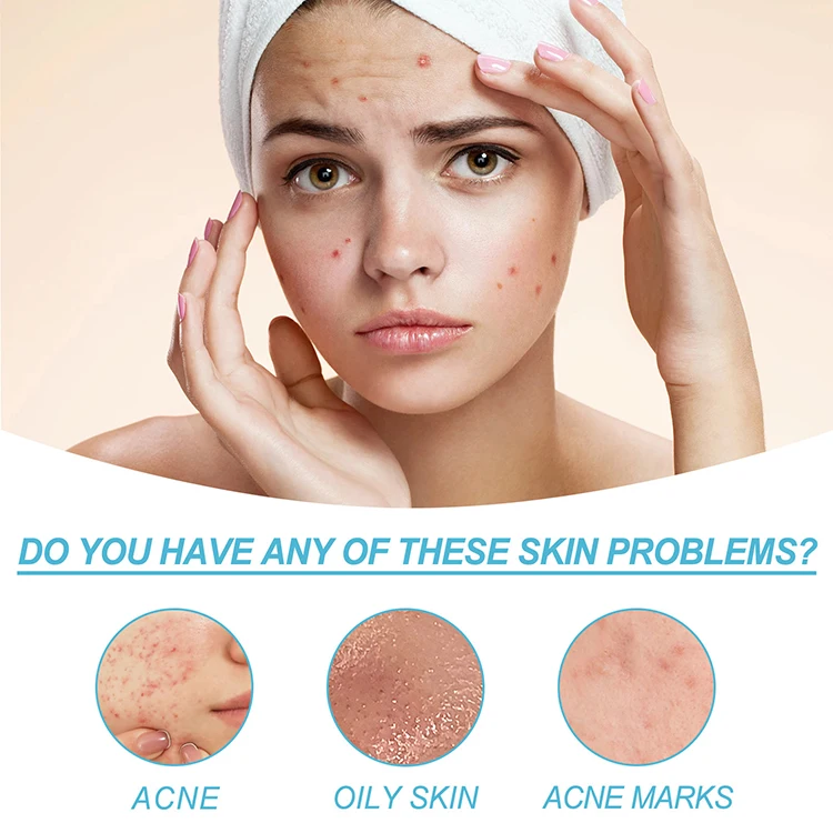 Cleaning Repair Pimples Smooths Skin Face Acid Gel Shrinks Pores Treatment Acne Salicylic Acid Gel