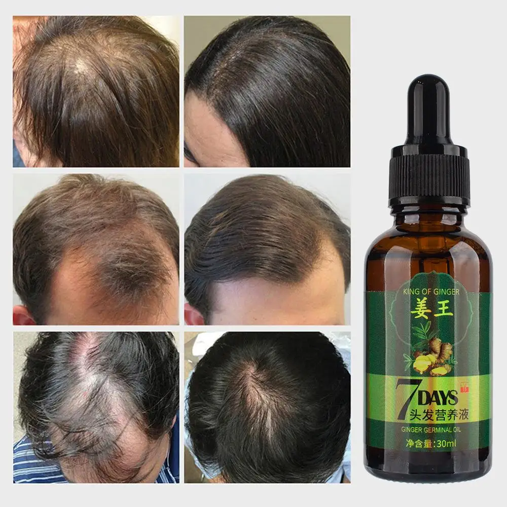 
Private Label High Quality Ginger Hair Growth Oil Organic ScalpTreatment Hair Regrowth Serum Oil Control 