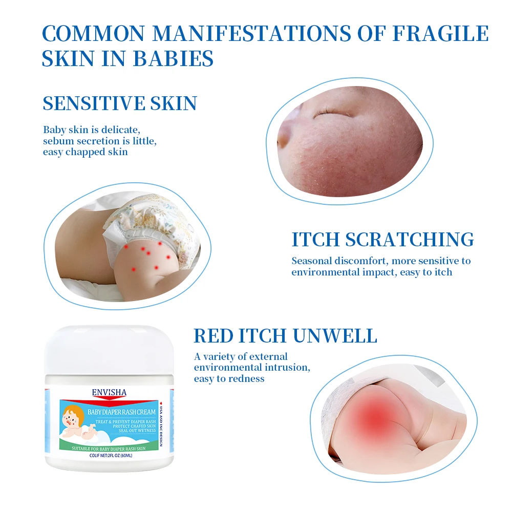 High Quality Moisturizing Calming Babies Diaper Rash Ointment Children Anti Chafing Bed Sores Skin Protectant Treatment Cream