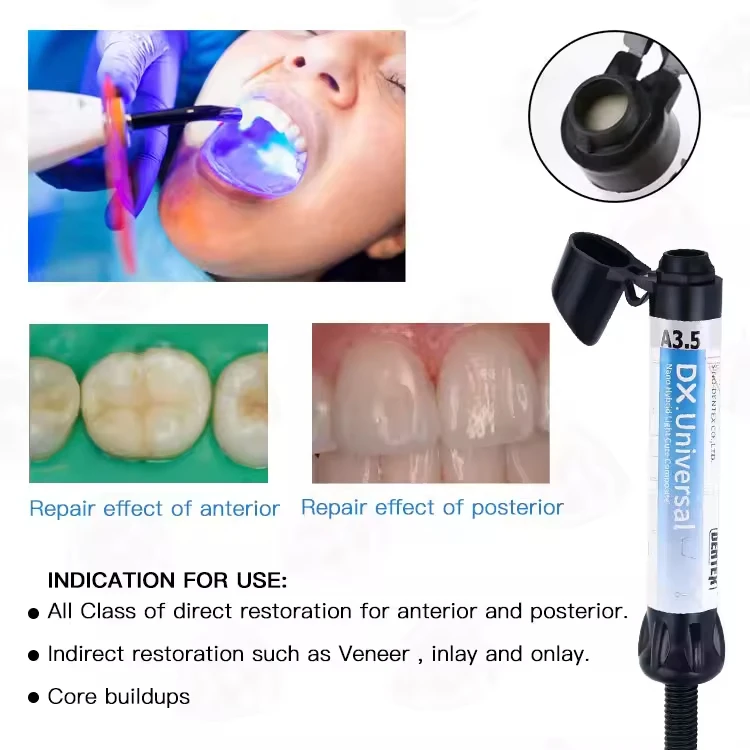 Dental composite resin Tooth Veneers Core Crown Restoration Dentistry Teeth Materials Filling