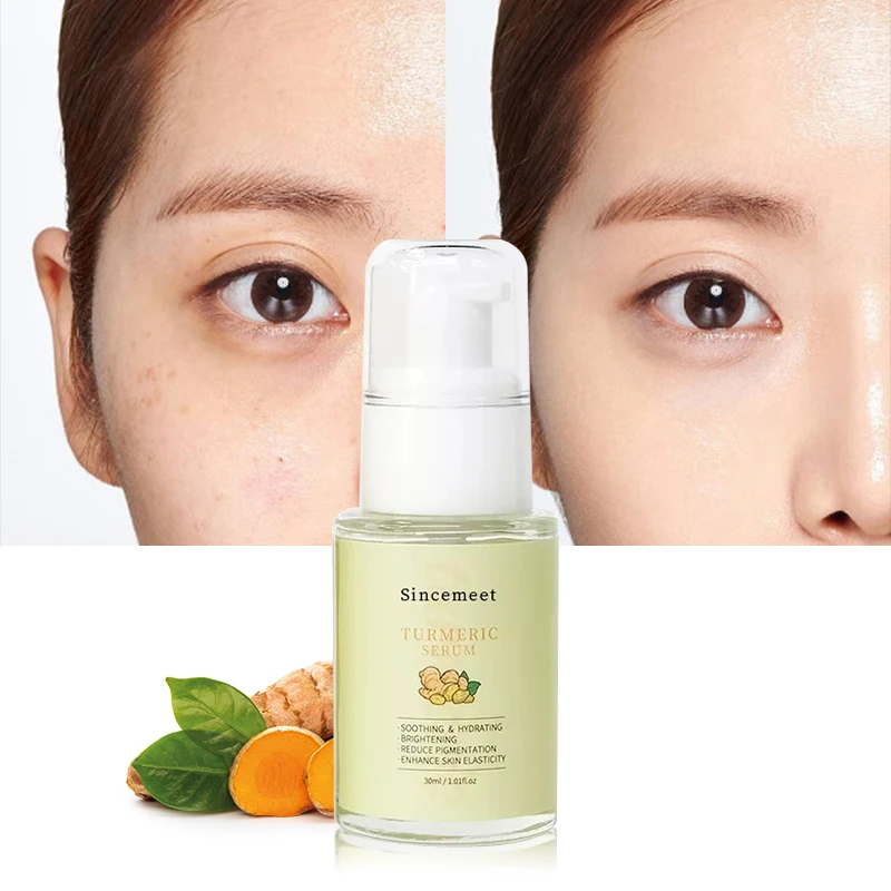 Private Label Skincare Turmeric oil Facial Lightening Soothing Organic Ginger Vitamin C Turmeric Face Serum