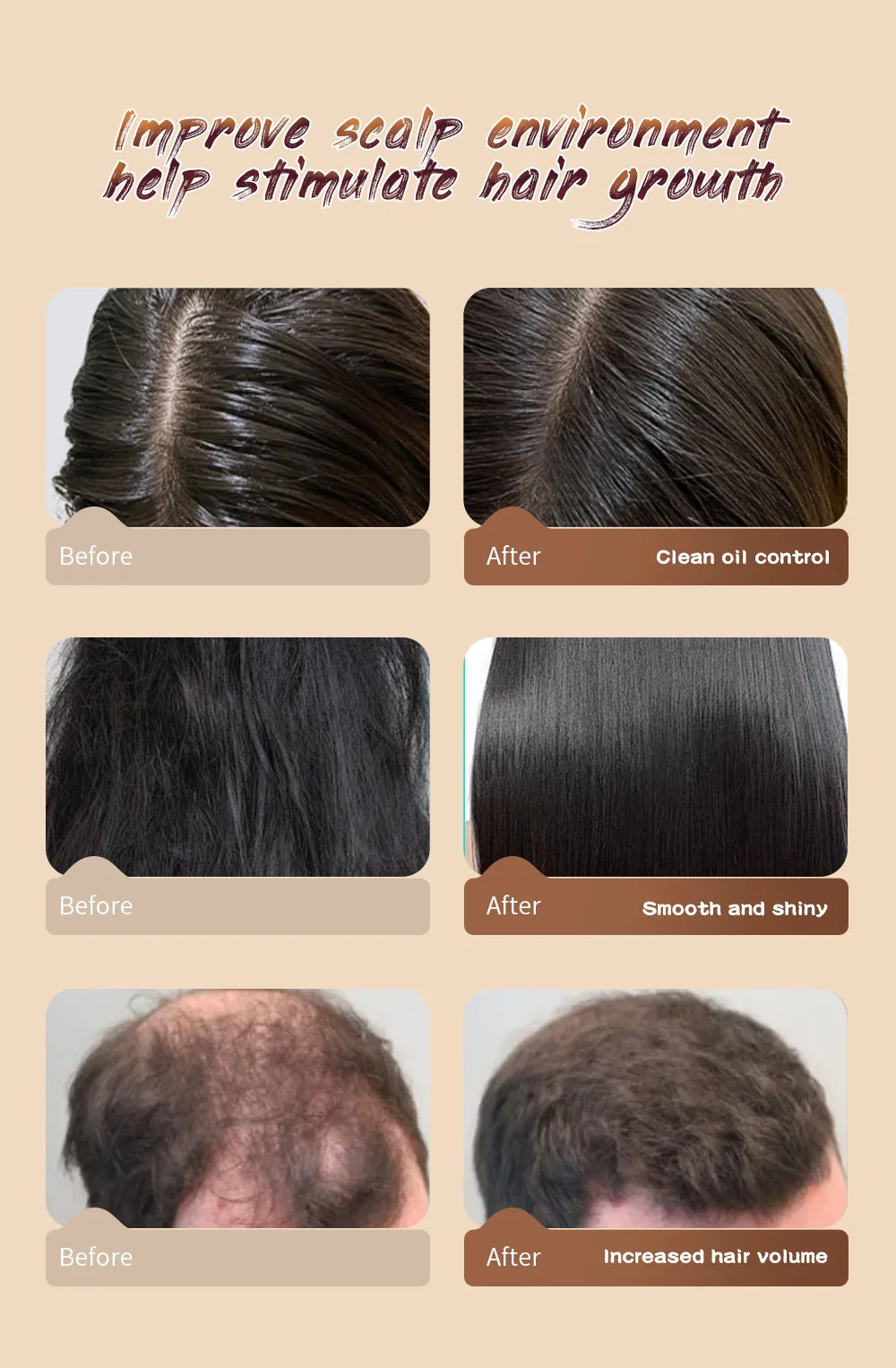 Natural Organic Hair Care Anti Hair Loss Sulphate Chebe Hair Growth Free Shampoo And Conditioner Set