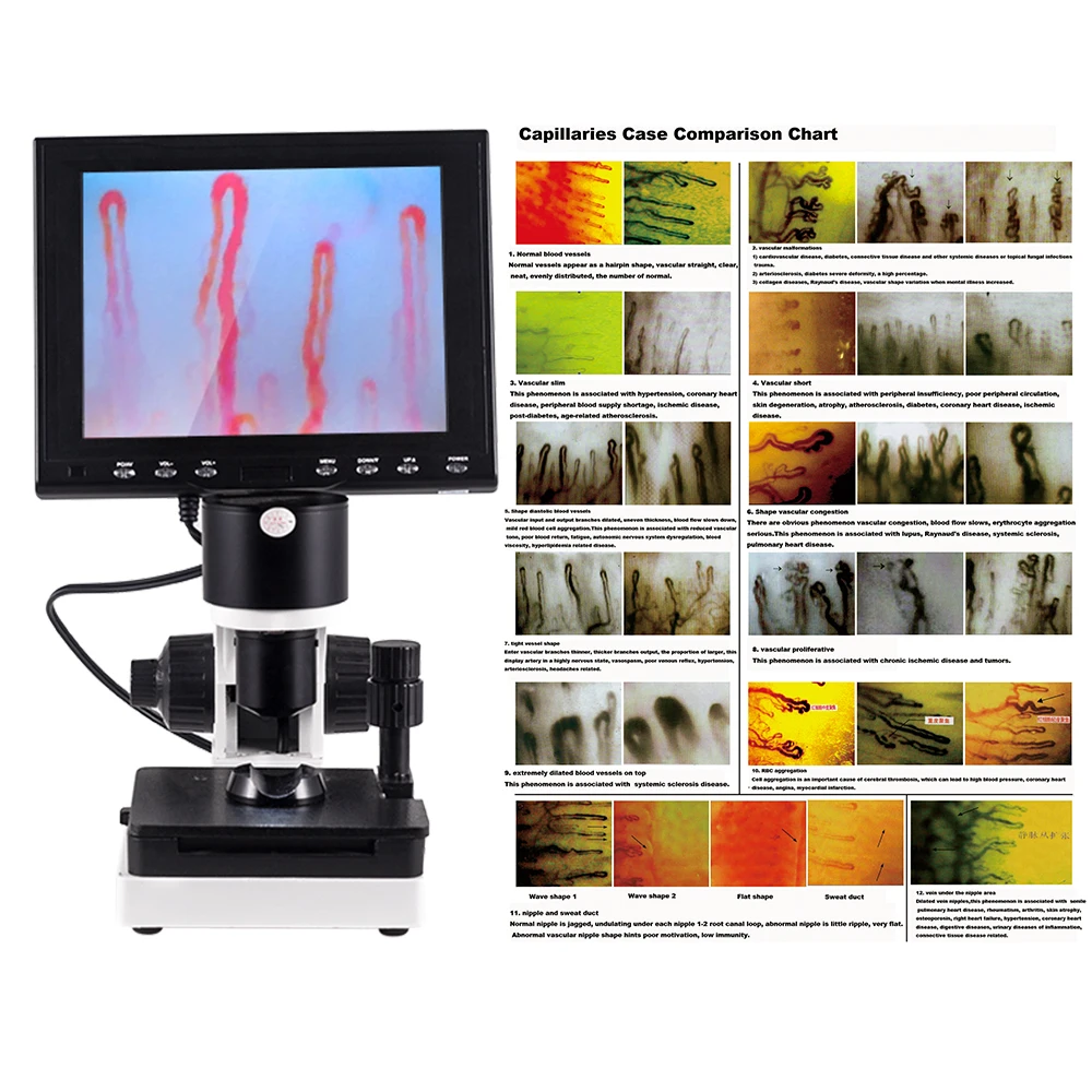 12 inch LCD blood circulation analysis clinical use analysis 680X Nailfold capillary microcirculation microscope