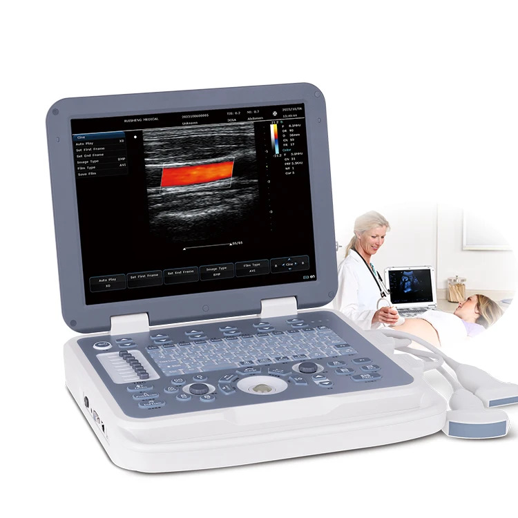 Mindray Ultrasound Machine Color Doppler 3d 4d Ultrasound Scanner Medical Echo Ultrasound Machine for Pregnancy