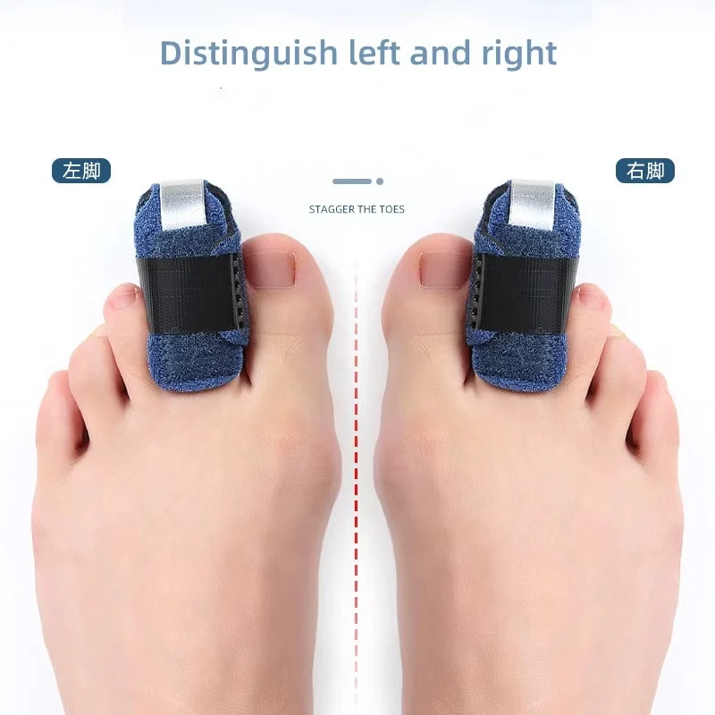 Wholesale Crooked hammer toe relieve pain adjustable straps fabric aluminum plate toe straighteners shields splint