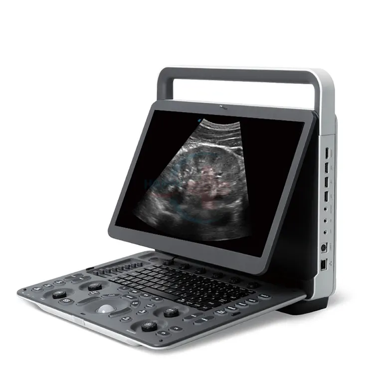 E2V (3).jpg