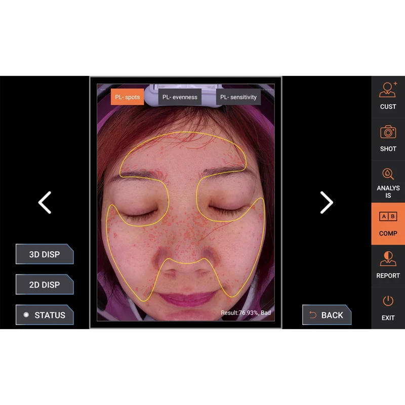 tester  diagnosis hair digital  type pigment volume 15 mp 10 care camera wireless wifi skin scalp analyzer
