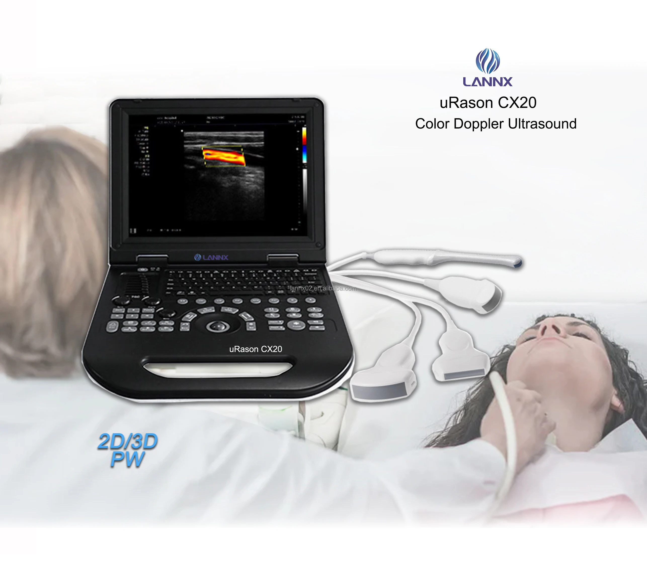 LANNX uRason CX20 In Stock product Laptop scanner ultrasonido ecografo sonography machine 2D/3D Color Doppler Ultrasound