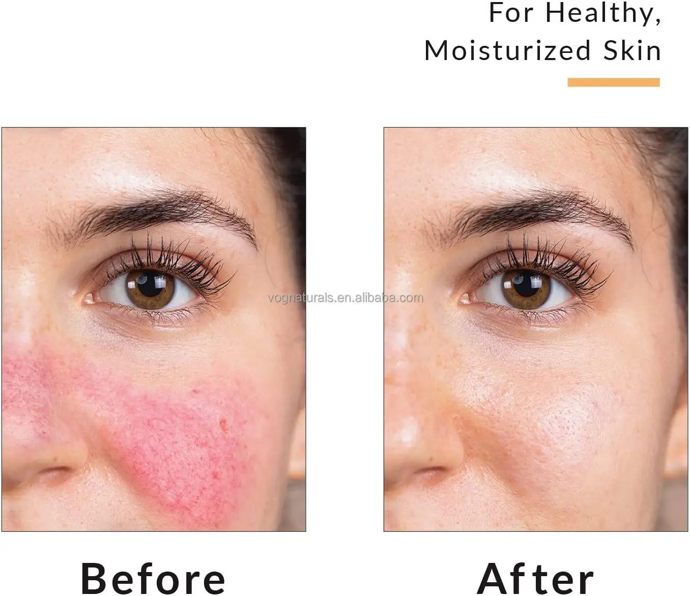 eczema cream 15.jpg