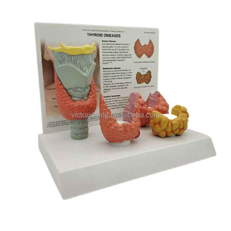 V-GF211208-1 Thyroid Pathology Model Endocrinology Department Thyroid Disease Teaching Demonstration Model