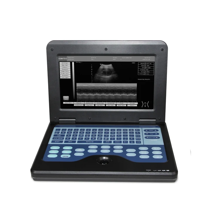  CONTEC CMS600P2 10 1 дюймов цифровой недорогой ноутбук портативный доплеровский ультразвуковой аппарат