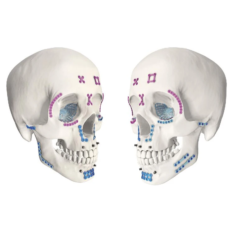 Orthopedic Titanium Maxillofacial Plate