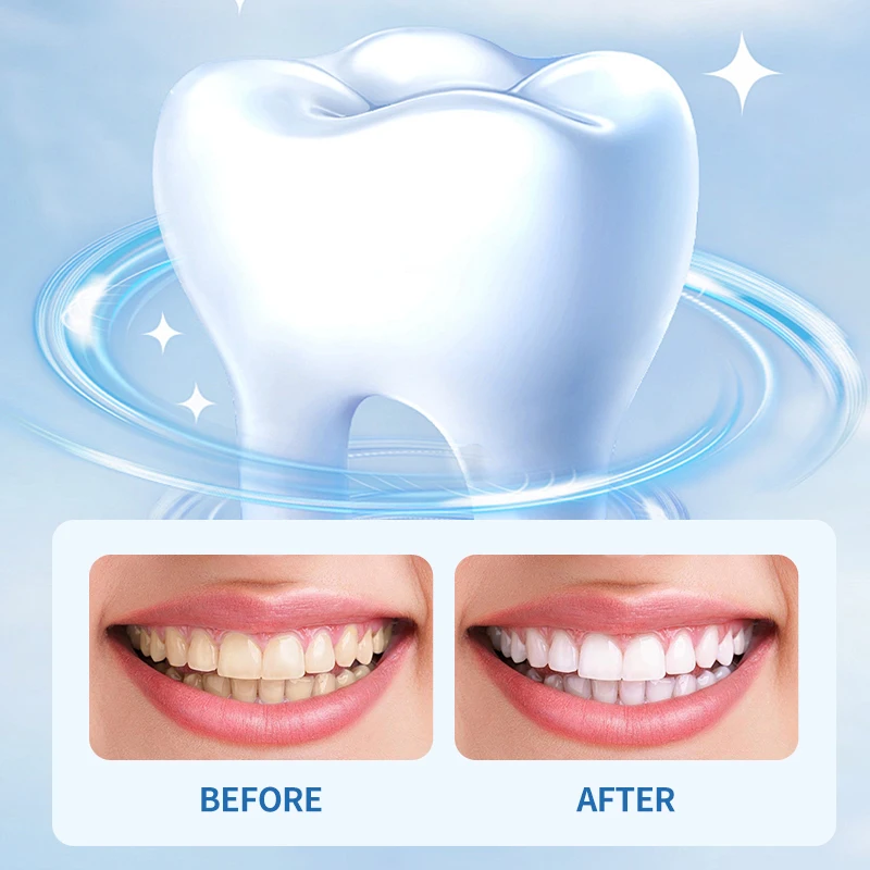 Natural Bad Breath Treatment Tonsil Stone Mouthwash Concentrated Pulling Oil For Teeth