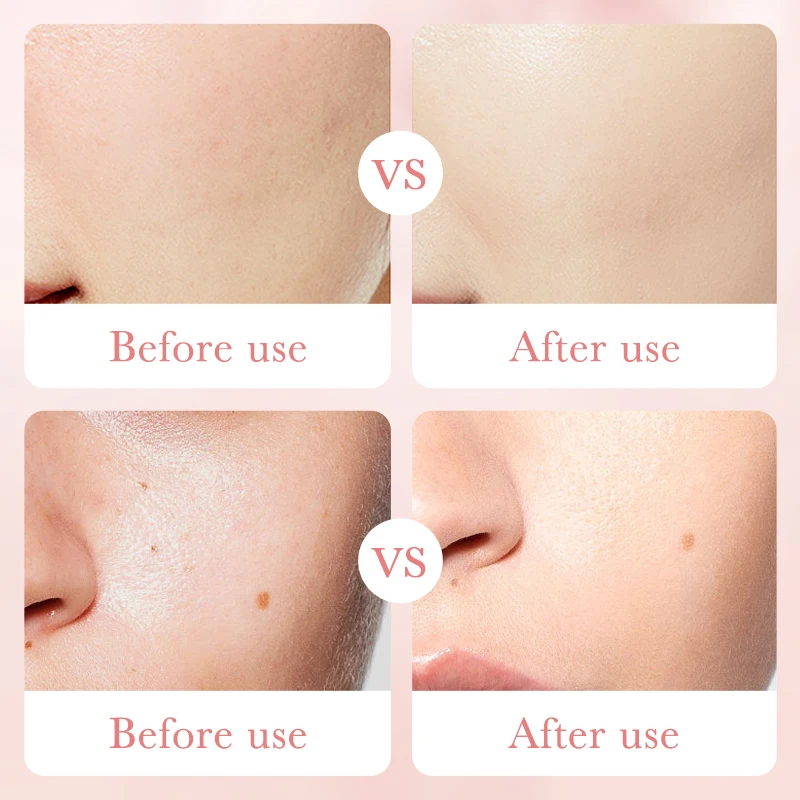 OEM BIOAQUA Hyaluronic Acid Rose Serum Skin Care Products Beauty Cosmetics Facial Anti-aging Moisturizing Whitening Repair Serum