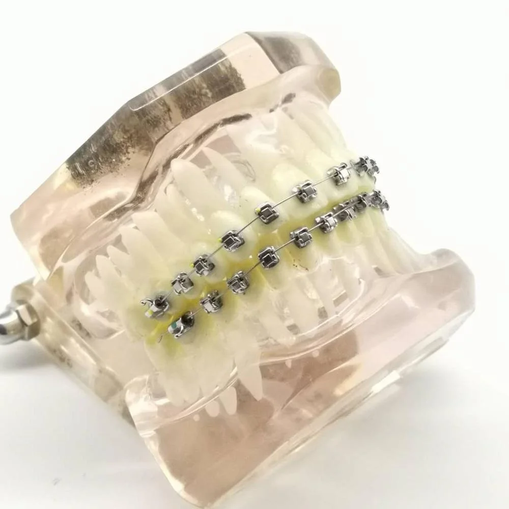 Orthodontic Good Quality Passive MBT MIM Bondable Dental Self-Ligating Orthodontic Brackets