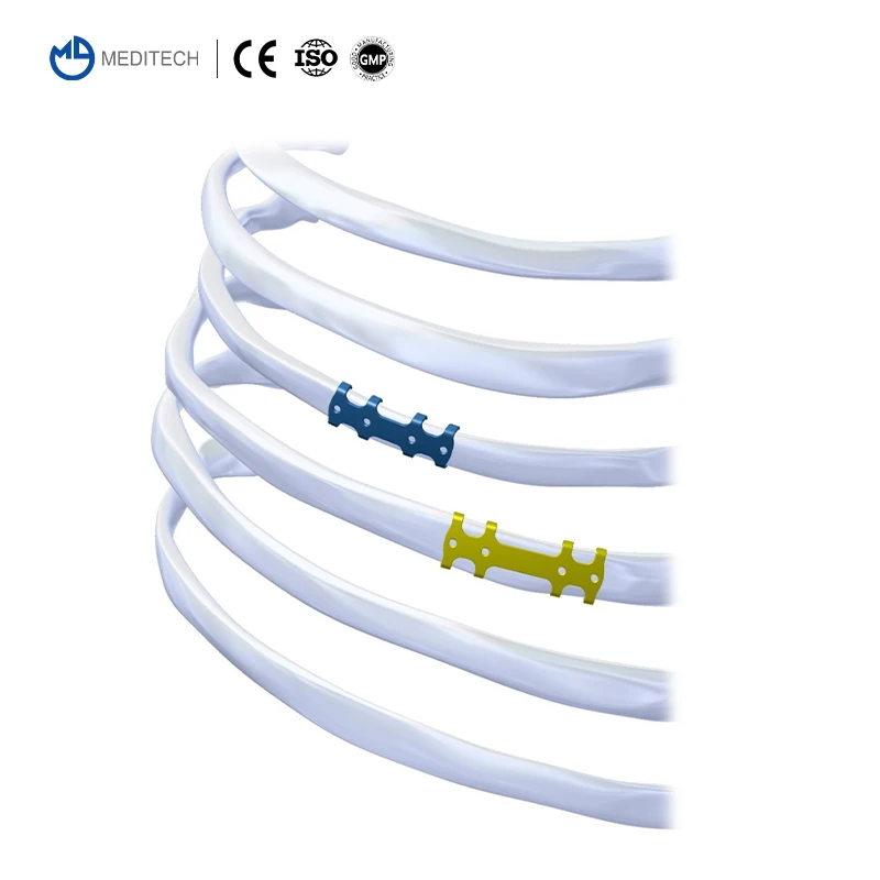 Orthopedic Titanium Patented Rib Bone Plate Ortho Implants For Rib Bone Fracture