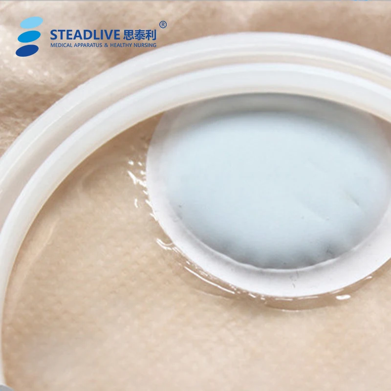 Double Cavity Colostomy Bag Supplier for Two Pieces Ileostomy Stoma Care Stoma Bag  Cover