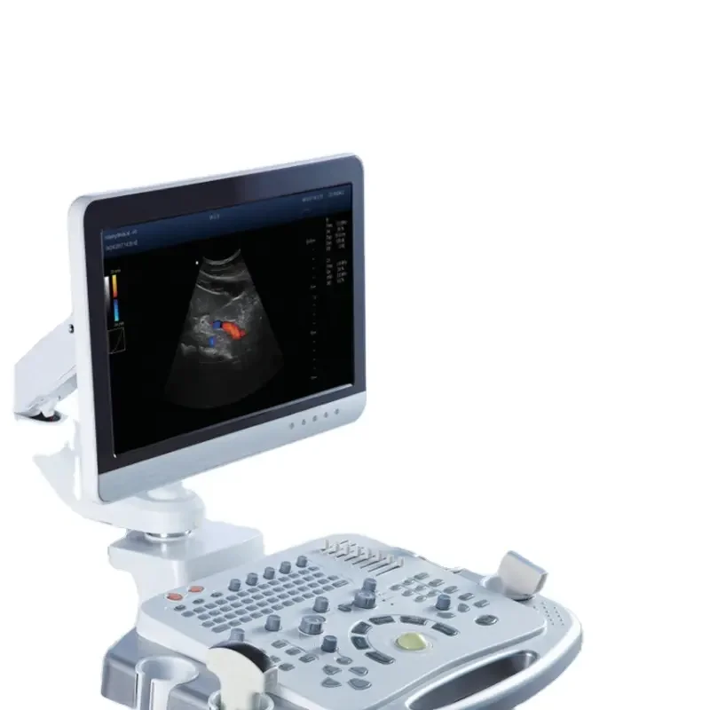 Hospital medical trolley color doppler ultrasound diagnostic instrument advanced device all digital diagnostic ultrasound system