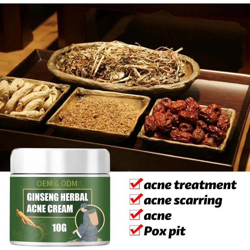 Facial Skin Care vitamin E Cream Anti-Acne  Acne Scar Removal Natural Herbal Extract Herbal Acne Removing Cream