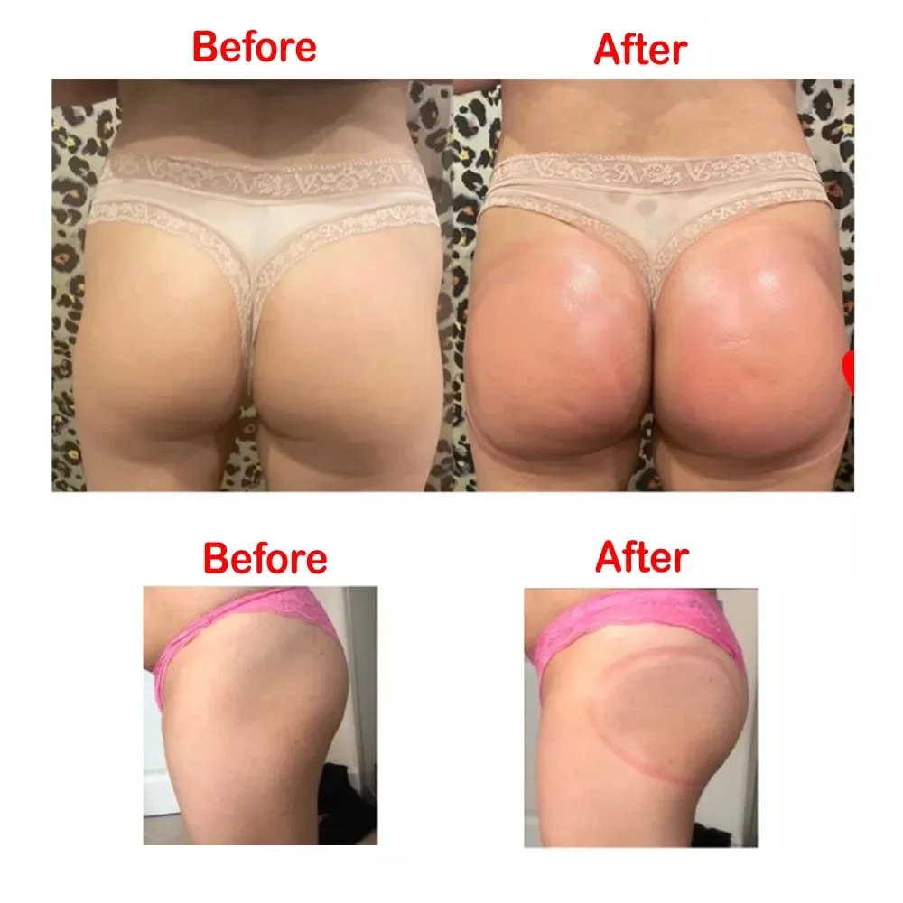 News Products 2024 Professional Big Breast Hip Suction Pump Enlargement Therapy Butt Lift Vacuum Machine With Buttock Cups