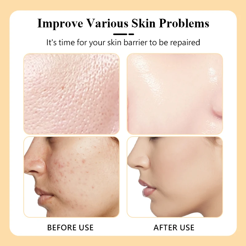 Fruit Flower Extract Facial Mask Powder Natural Jelly Mask For All Skin Types Facial Crystal Mask