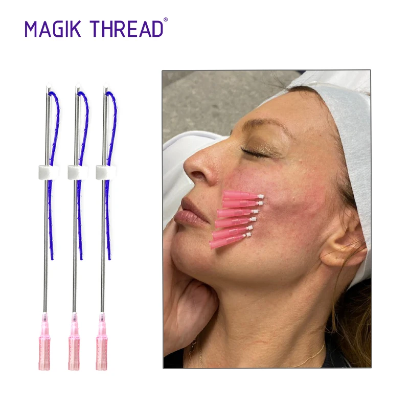 Magik Thread 6d/4D/3D face lifting thread pdo(Cog/Tornado/Mono/Screw)