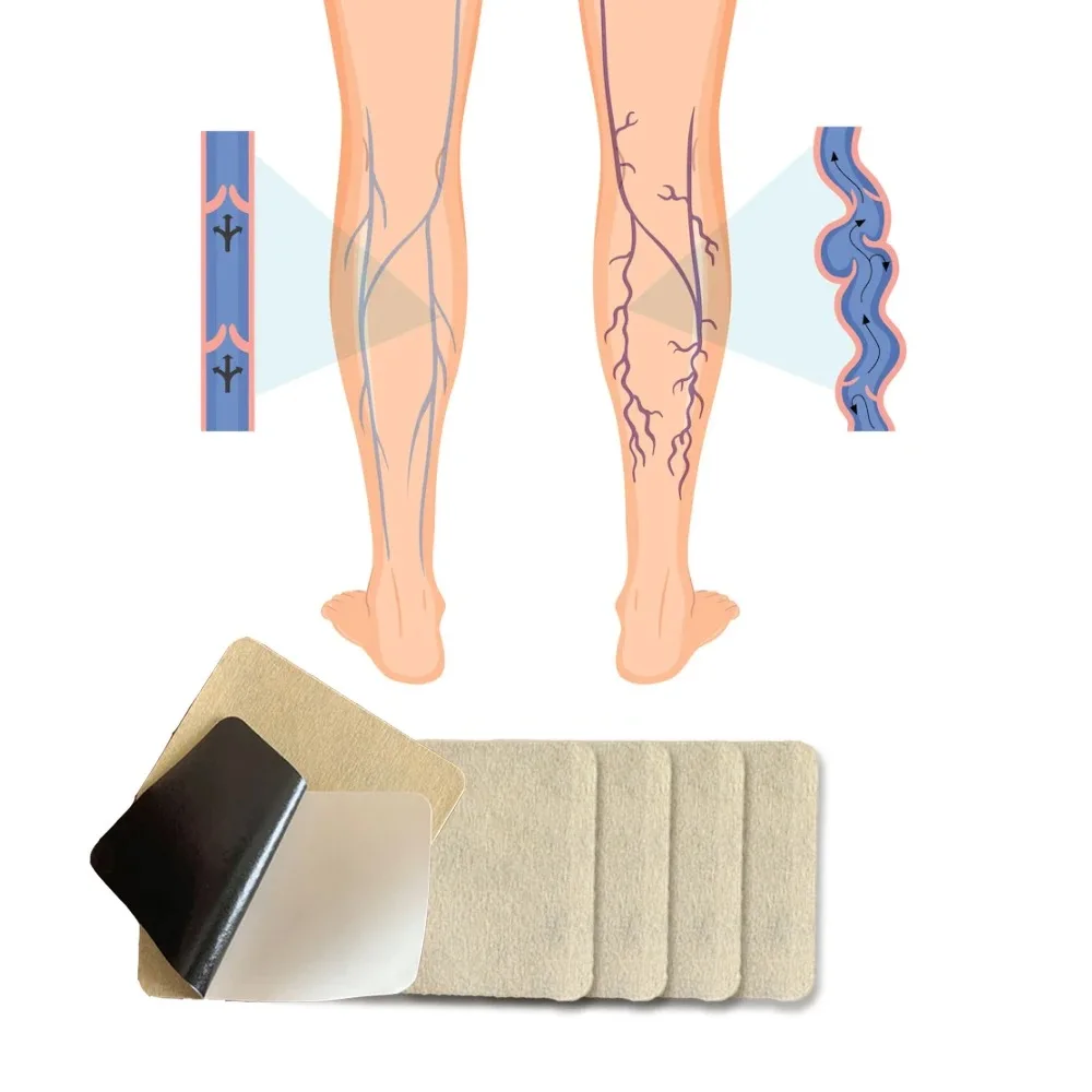New Product Natural Pain Relief Plaster Varicose Vein Healing Patch