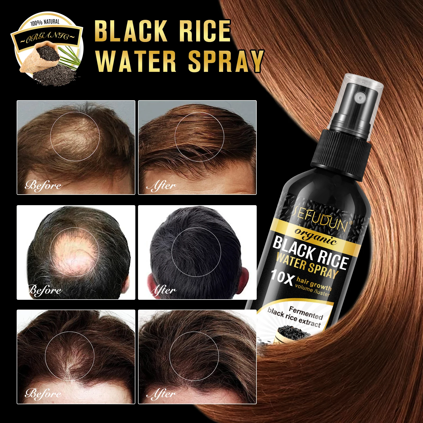 Fast Grow Hair Treatment Hair Loss Care Spray Biotin Black Rice Water Hair Growth Spray Serum For Men Women 100ml