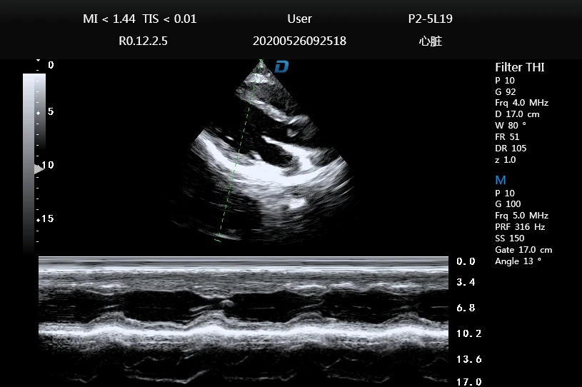 Portable cardiac ultrasound scanner color doppler ultrasound machine
