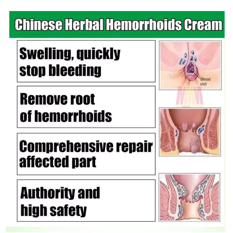 free shipping Ma Yinglong 25pcs Hemorrhoids Cream Oilment Original Sourcing Agent for male femal China brand products
