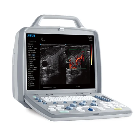 
15-inch medical LCD optional 8800Plus Color ultrasound 