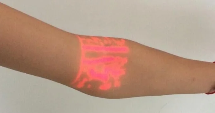 
mobile model medical vein locator infrared adjustable projection vein finders 