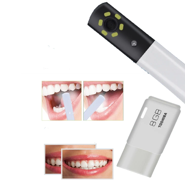 17 Inches 1/4 CMOS HD Digital Dental Intra Oral Camera With Wifi Dental Intraoral Scanner