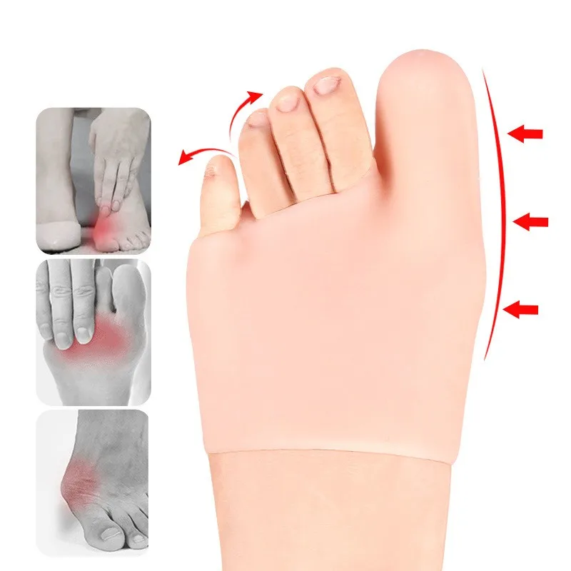 Big foot thumb head toe valgus orthosis
