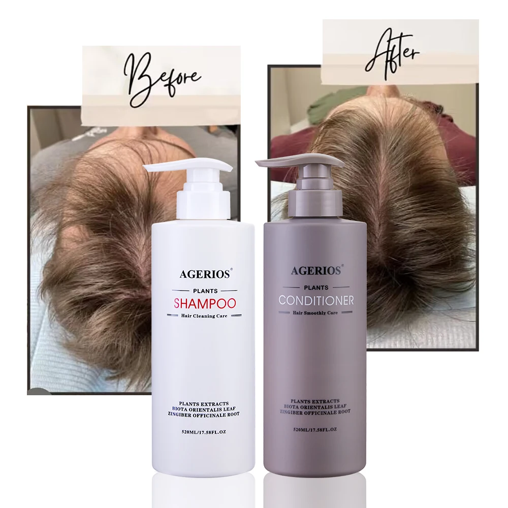 Parabens Free Sulfate Free Organic Herbal Ginseng Oil Control Hair Growth Shampoo with Natural Hair Loss Treatment Essence