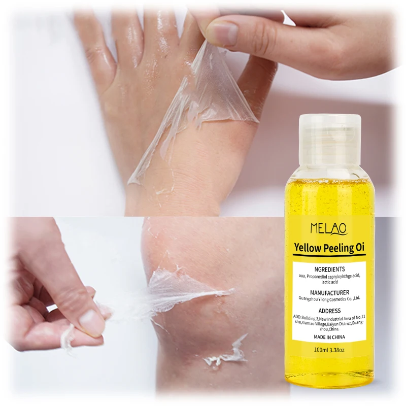 Private Label Natural Whitening Yellow Peeling Oil Remove Skin Layer Strong Dark Knuckles Black Skin Care Peeling Essential Oil