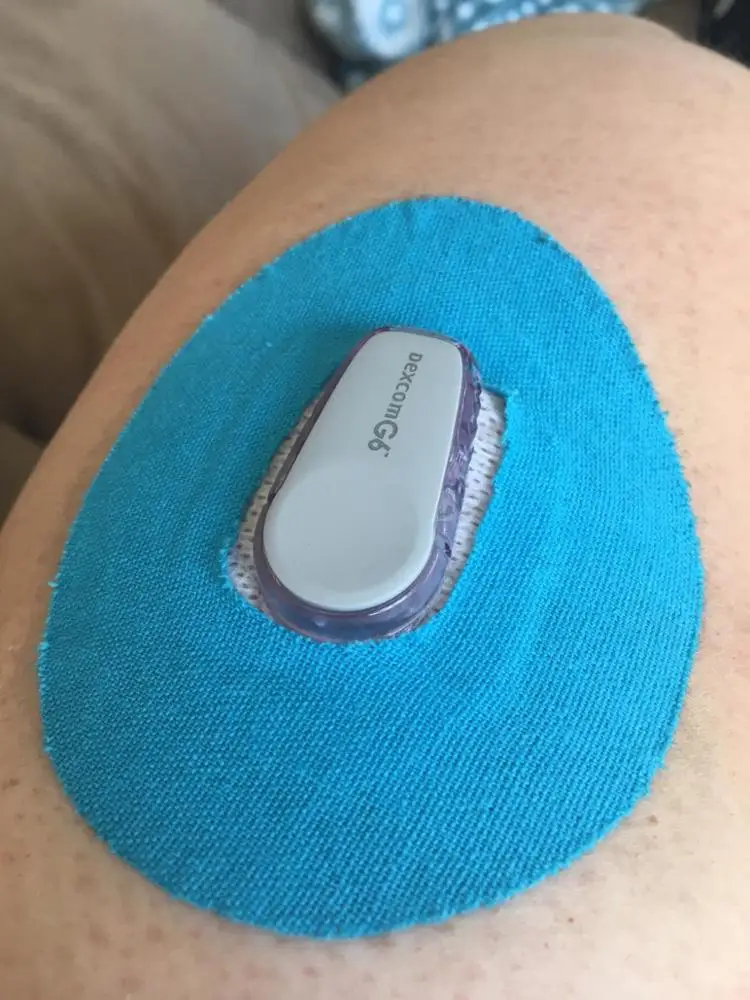 Патчи от производителя покрывающие датчики Cgm адгезивы для диабетиков Dexcom G6 клейкие